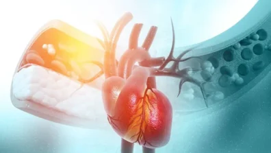 نصائح لتعزيز الوقاية من النوبات القلبية والسكتات