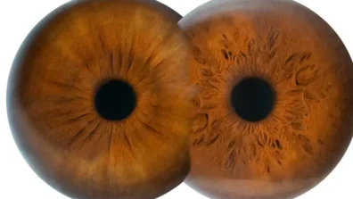 رؤى علمية رائدة لعلاج العمى الوراثي