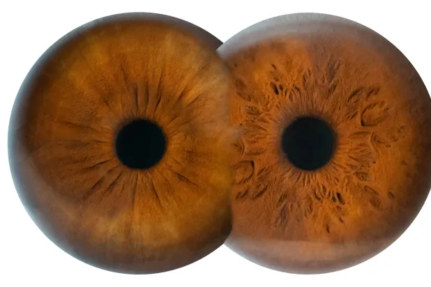 رؤى علمية رائدة لعلاج العمى الوراثي