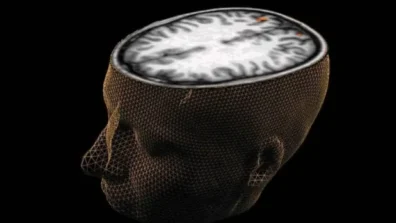 باحثون يكتشفون مؤشراً حيوياً قد يسهم في تحسين علاج الفصام