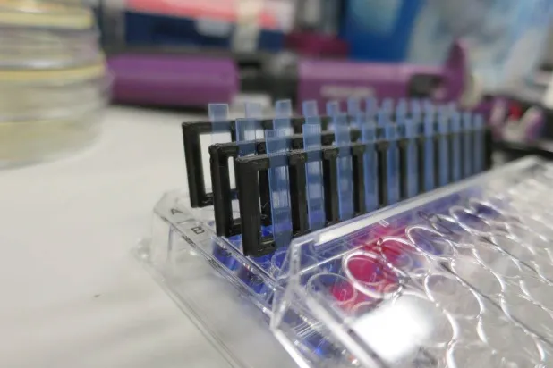 تقنية جديدة تسرّع علاج التهاب المسالك البولية