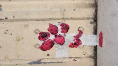 الشلل والموت مقابل السعر الأرخص… حين تتحوّل الحقنة إلى مغامرة قاتلة