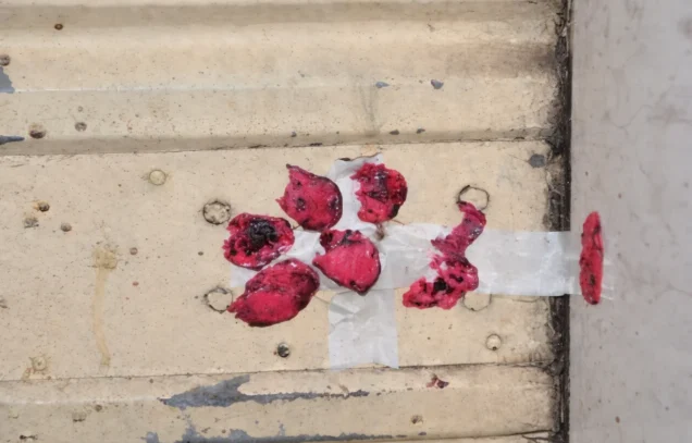 الشلل والموت مقابل السعر الأرخص… حين تتحوّل الحقنة إلى مغامرة قاتلة