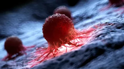 ابتكار نموذج رياضي يتنبأ بمستقبل انتشار الخلايا السرطانية