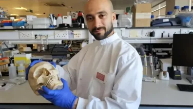 مادة مبتكرة من الصوف لعلاج كسور العظام