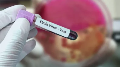 الفيروسات الناشئة… بين الحقيقة العلمية والهلع الاجتماعي