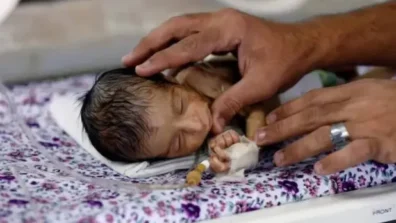 الأوبئة والفساد ينهكان قطاع الصحة في اليمن